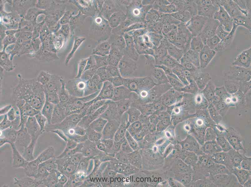 HCC4006 (人肺癌腺癌細(xì)胞) (STR鑒定正確)