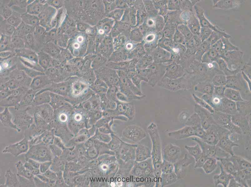 HCC4006 (人肺癌腺癌細(xì)胞) (STR鑒定正確)