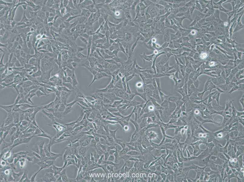 HTR-8-Svneo (人絨毛膜滋養(yǎng)層細胞) (STR鑒定正確)