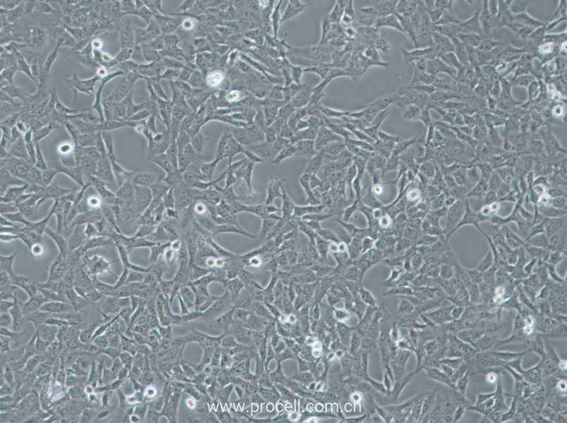 HTR-8-Svneo (人絨毛膜滋養(yǎng)層細胞) (STR鑒定正確)