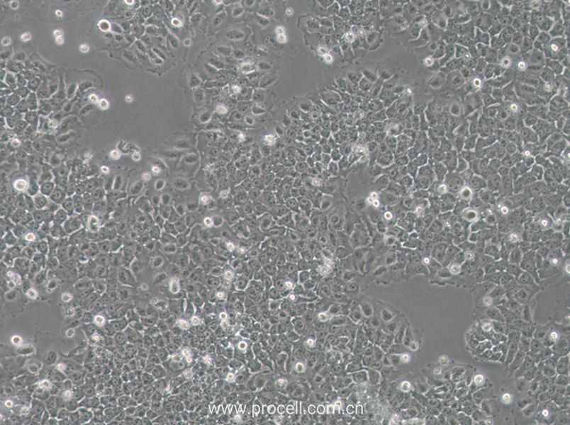 SACC-83 (人涎腺腺樣囊性癌細胞) (STR鑒定正確)