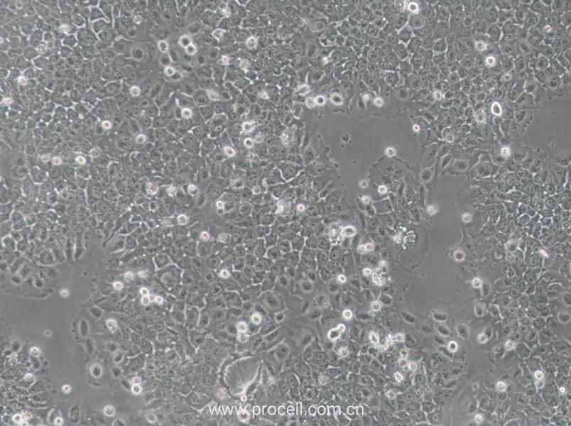 SACC-83 (人涎腺腺樣囊性癌細胞) (STR鑒定正確)