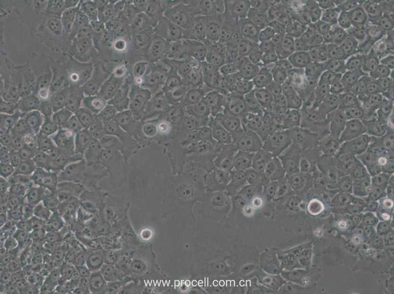 SACC-83 (人涎腺腺樣囊性癌細胞) (STR鑒定正確)