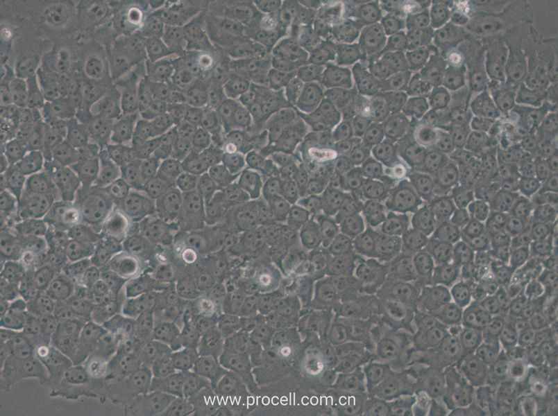 SACC-83 (人涎腺腺樣囊性癌細胞) (STR鑒定正確)