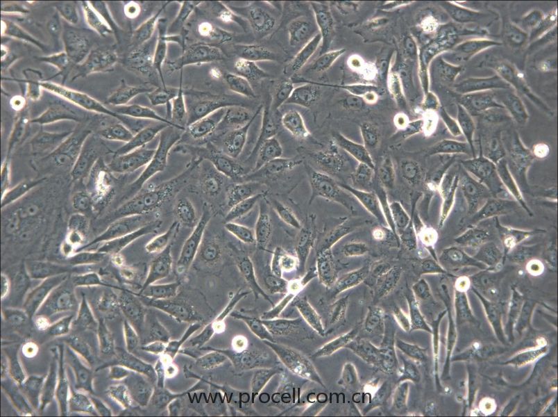 HS-5 (人骨髓基質(zhì)細胞) (STR鑒定正確)
