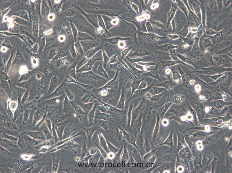 HS-5 (人骨髓基質(zhì)細胞) (STR鑒定正確)