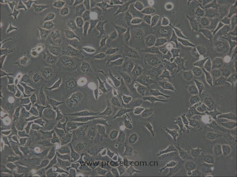 NP69SV40T (人鼻咽上皮細(xì)胞) (STR鑒定正確)