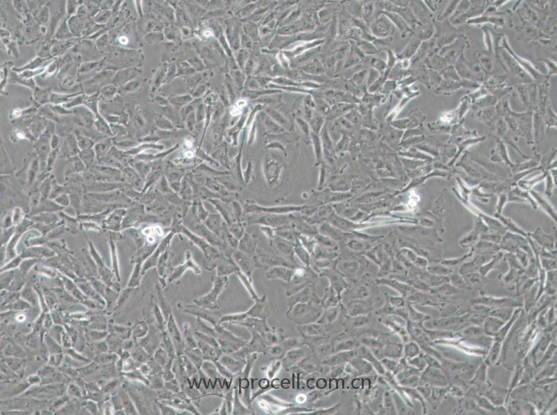 OCUT-2C (人甲狀腺癌細(xì)胞（未分化）) (STR鑒定正確)