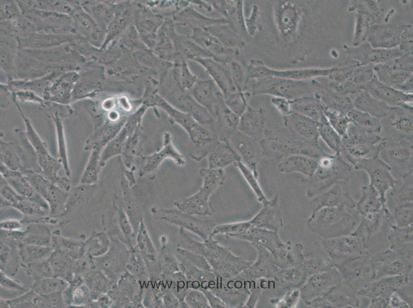 OCUT-2C (人甲狀腺癌細(xì)胞（未分化）) (STR鑒定正確)