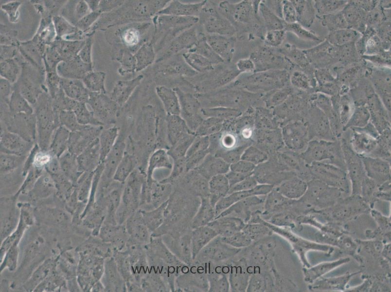 OCUT-2C (人甲狀腺癌細(xì)胞（未分化）) (STR鑒定正確)