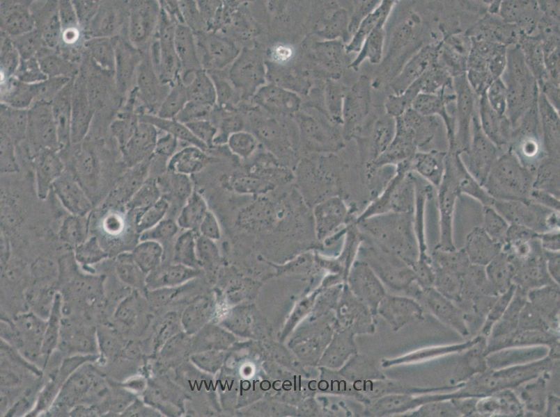 OCUT-2C (人甲狀腺癌細(xì)胞（未分化）) (STR鑒定正確)