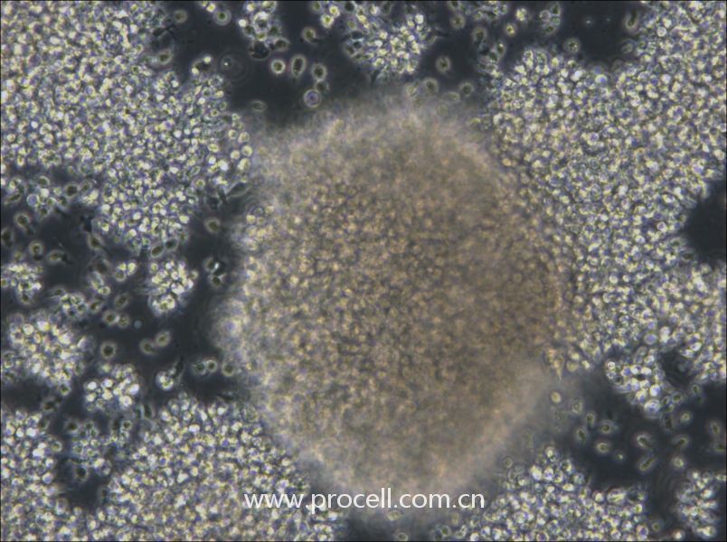 NCI-BL2009 (人淋巴母細(xì)胞（EBV 轉(zhuǎn)化）) (STR鑒定正確)