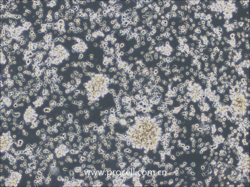 HCC38 BL (人淋巴母細(xì)胞（EBV 轉(zhuǎn)化）) (STR鑒定正確)