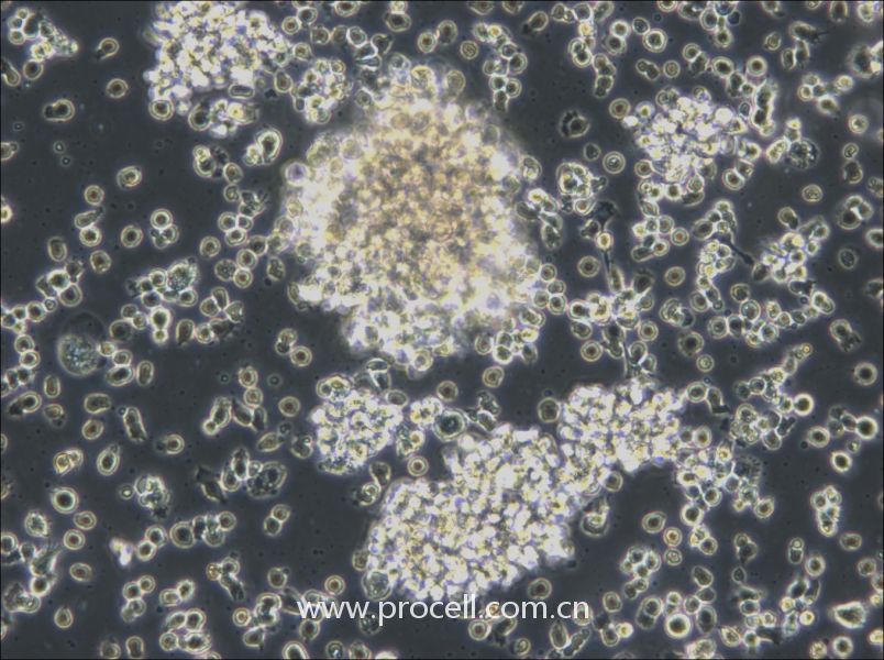 HCC38 BL (人淋巴母細(xì)胞（EBV 轉(zhuǎn)化）) (STR鑒定正確)