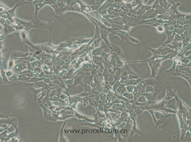 HCC70 (人乳腺導(dǎo)管癌細(xì)胞) (STR鑒定正確)