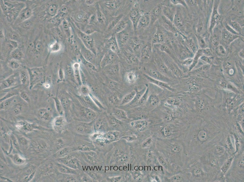 SW1710 (人膀胱癌細胞) (STR鑒定正確)