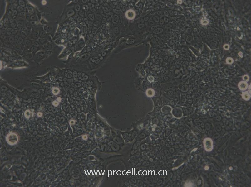 SW1417 (人結(jié)腸直腸腺癌細(xì)胞) (STR鑒定正確)