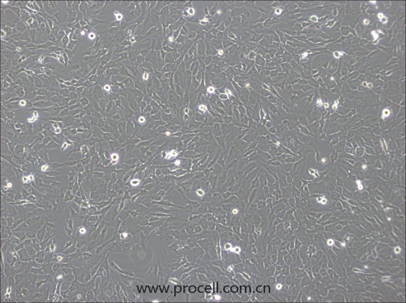 hCMEC/D3 (人腦微血管內(nèi)皮細(xì)胞) (STR鑒定正確)