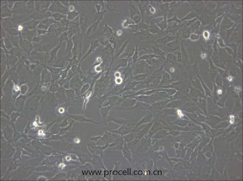 hCMEC/D3 (人腦微血管內(nèi)皮細(xì)胞) (STR鑒定正確)