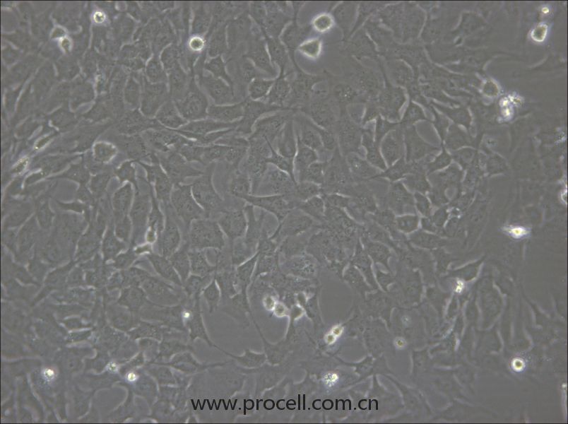 hCMEC/D3 (人腦微血管內(nèi)皮細(xì)胞) (STR鑒定正確)