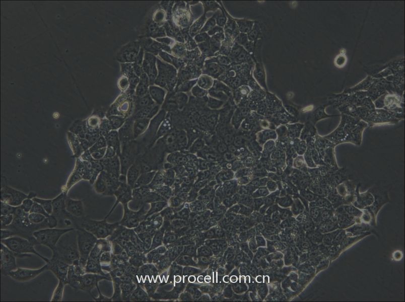 OE33 (人食管腺癌細胞) (STR鑒定正確)