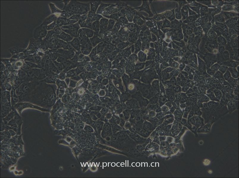 OE33 (人食管腺癌細胞) (STR鑒定正確)