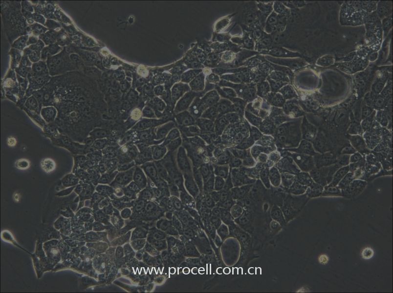 OE33 (人食管腺癌細胞) (STR鑒定正確)