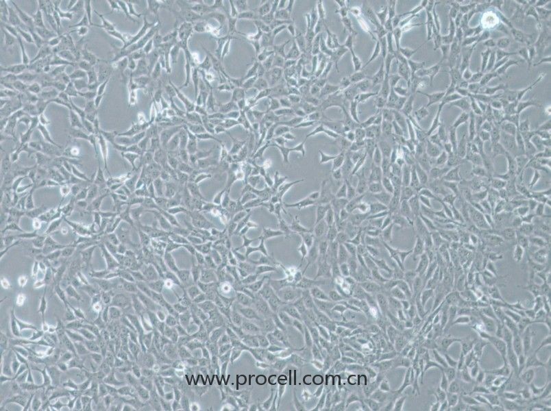 MPC-5 (小鼠腎足細(xì)胞) (STR鑒定正確)
