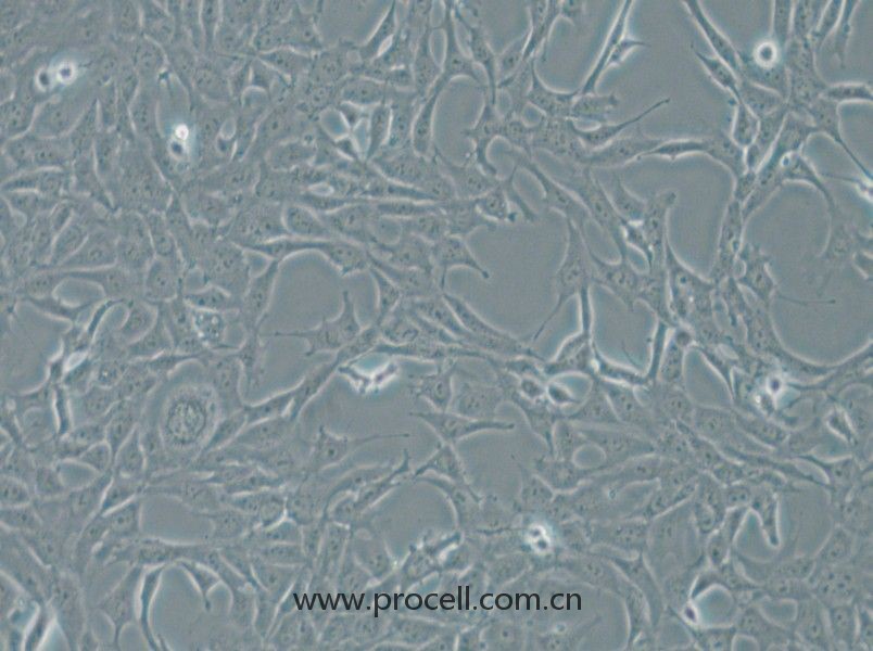 MPC-5 (小鼠腎足細(xì)胞) (STR鑒定正確)