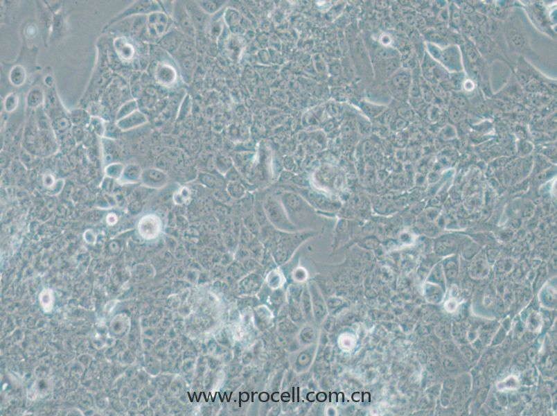 NCI-H1793 (人肺癌細胞) (STR鑒定正確)