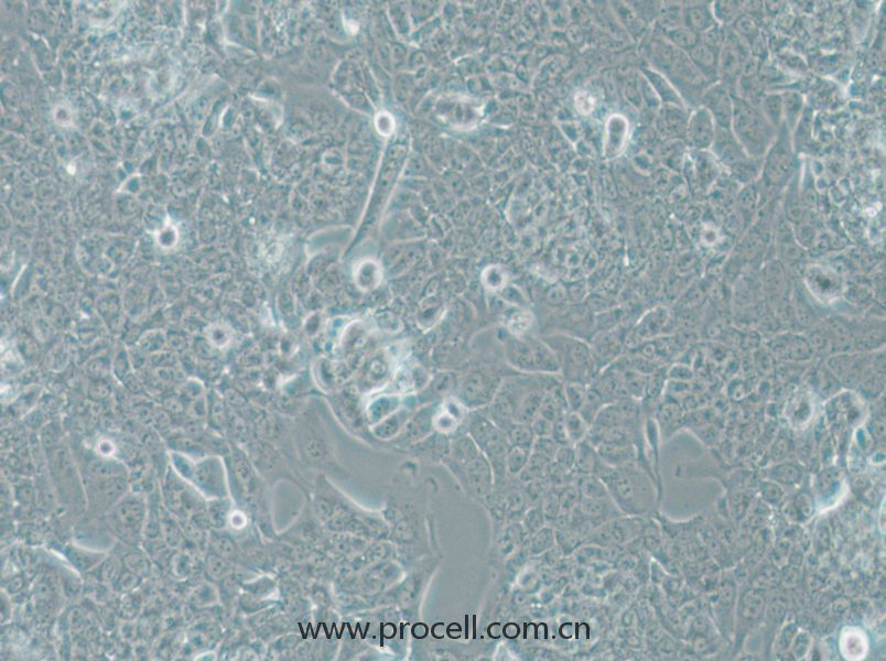 NCI-H1793 (人肺癌細胞) (STR鑒定正確)