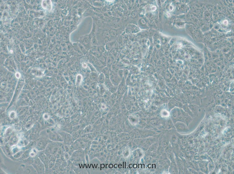 NCI-H1793 (人肺癌細胞) (STR鑒定正確)