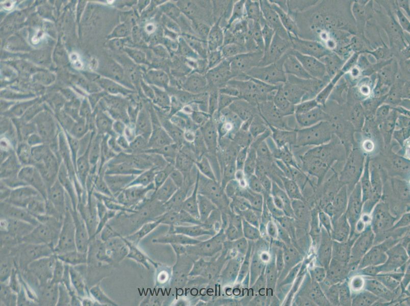 SW1271 (人小細(xì)胞肺癌細(xì)胞) (STR鑒定正確)