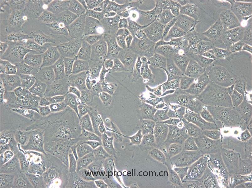 NCI-H1693 (人肺腺癌細胞) (STR鑒定正確)