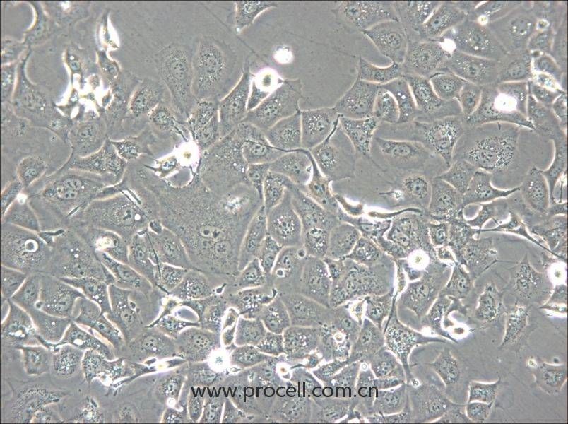 NCI-H1693 (人肺腺癌細胞) (STR鑒定正確)