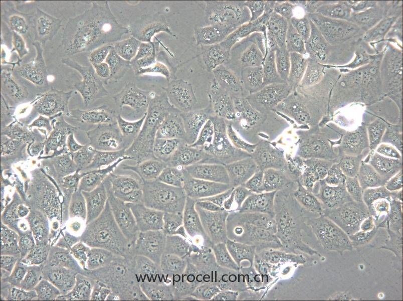 NCI-H1693 (人肺腺癌細胞) (STR鑒定正確)