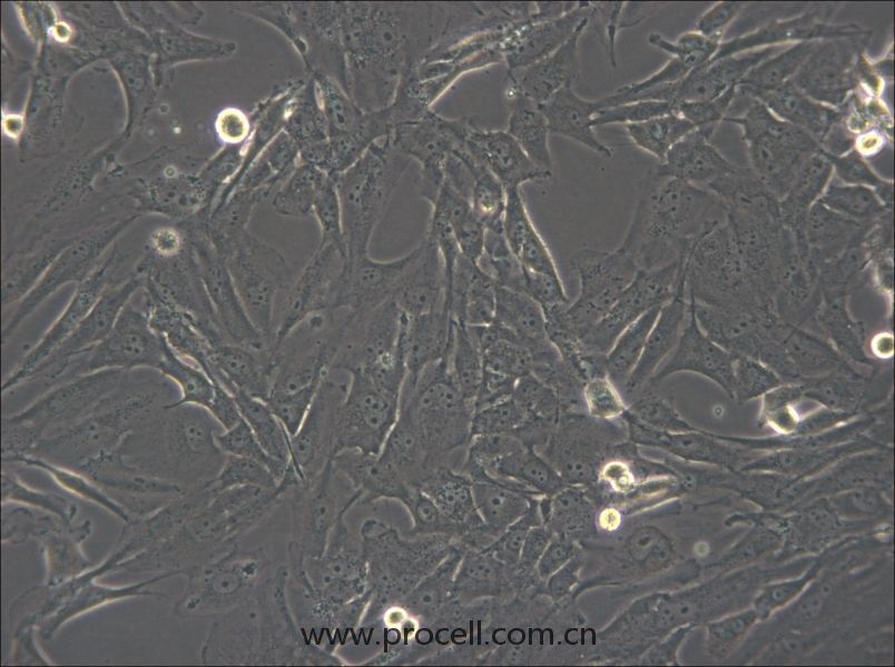 SW1783  (人腦星形膠質(zhì)細(xì)胞瘤細(xì)胞) (STR鑒定正確)