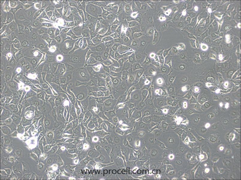 HSC-2 (人口腔鱗狀腫瘤細(xì)胞) (STR鑒定正確)