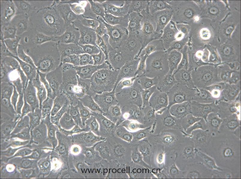 HSC-2 (人口腔鱗狀腫瘤細(xì)胞) (STR鑒定正確)