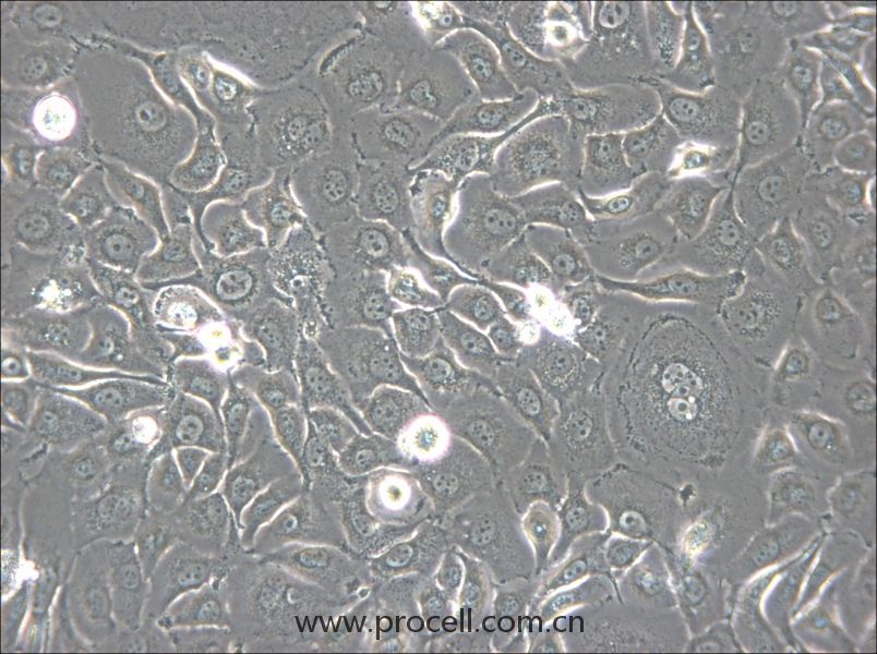 HSC-2 (人口腔鱗狀腫瘤細(xì)胞) (STR鑒定正確)