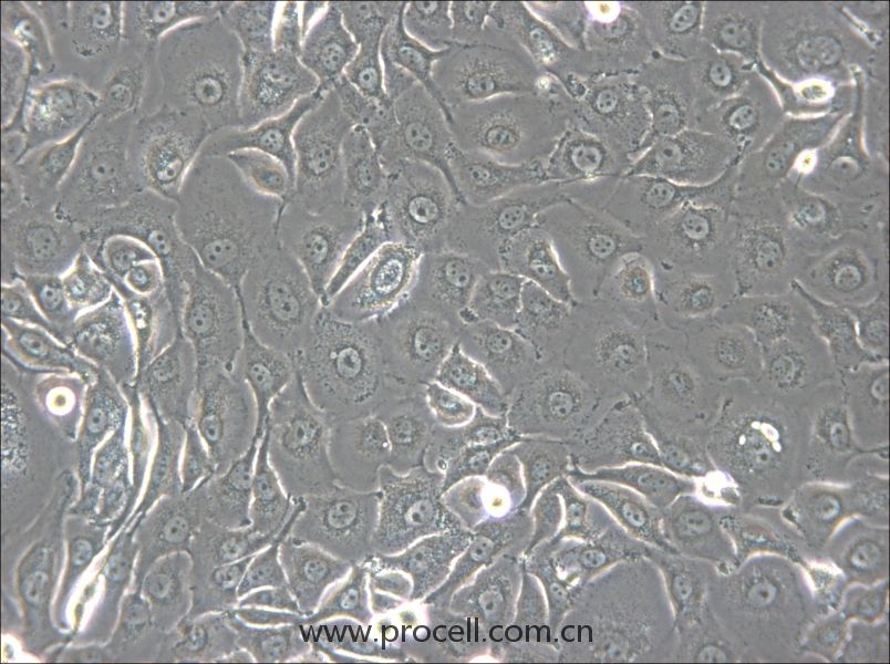 HSC-2 (人口腔鱗狀腫瘤細(xì)胞) (STR鑒定正確)