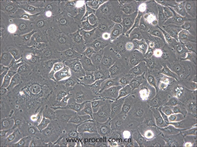 HSC-2 (人口腔鱗狀腫瘤細(xì)胞) (STR鑒定正確)