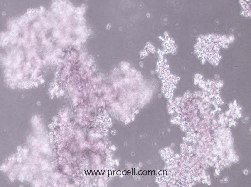 NCI-H660 (人神經(jīng)內(nèi)分泌前列腺癌細(xì)胞) (STR鑒定正確)