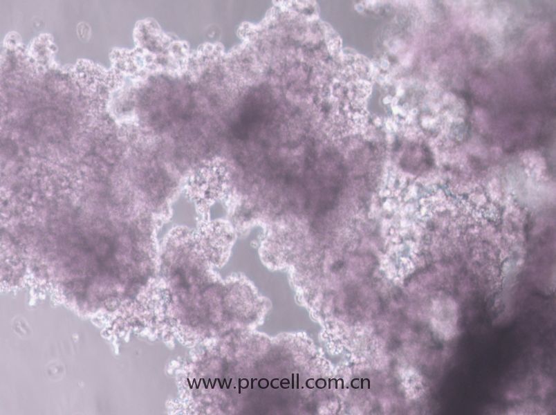 NCI-H660 (人神經(jīng)內(nèi)分泌前列腺癌細(xì)胞) (STR鑒定正確)