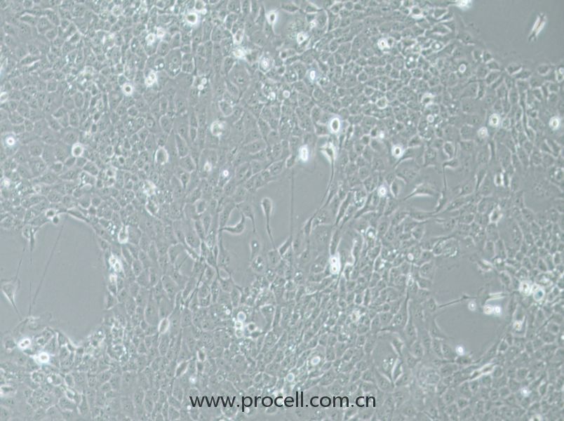 UM-SCC-1 (人口底鱗癌細胞) (STR鑒定正確)