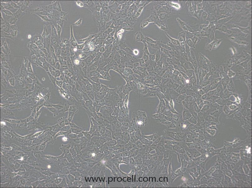 NCI-H1792(人肺腺癌細(xì)胞) (STR鑒定正確)