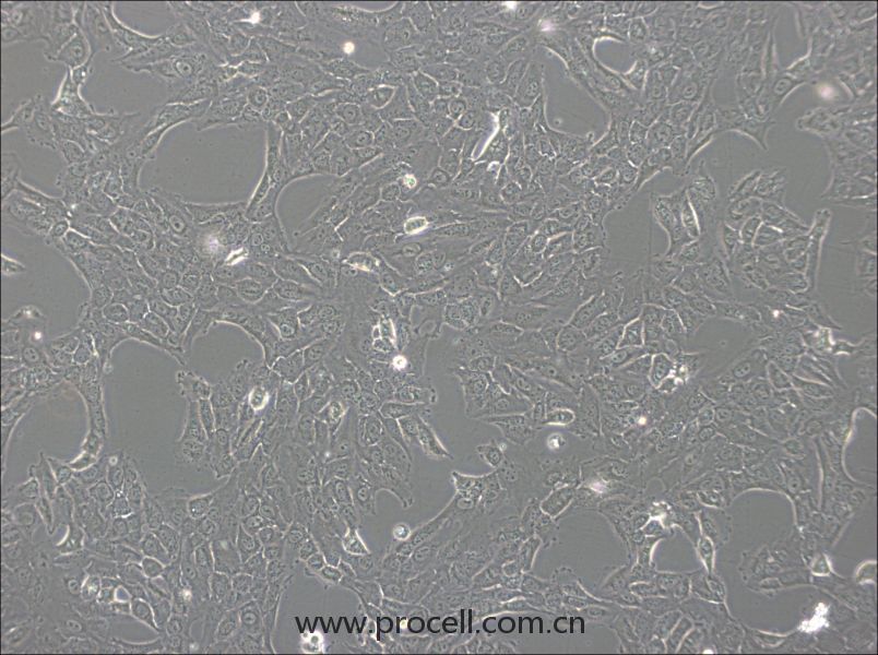 NCI-H1792(人肺腺癌細(xì)胞) (STR鑒定正確)