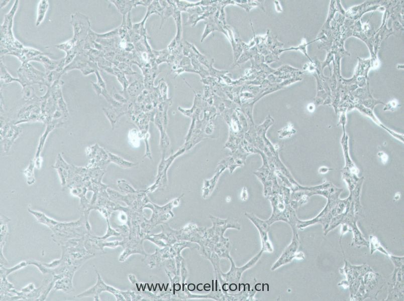 HLE-B3 (人晶狀體上皮細(xì)胞) (STR鑒定正確)