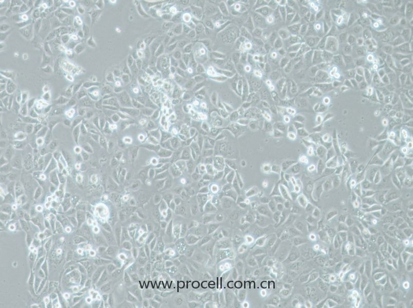 COLO-680N (人食管鱗狀細(xì)胞癌) (STR鑒定正確)