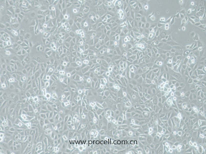 COLO-680N (人食管鱗狀細(xì)胞癌) (STR鑒定正確)